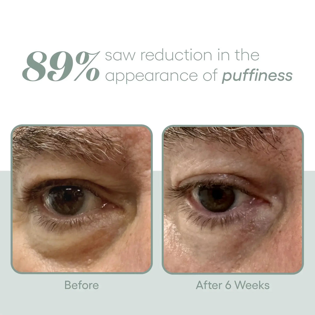 Eye Serum