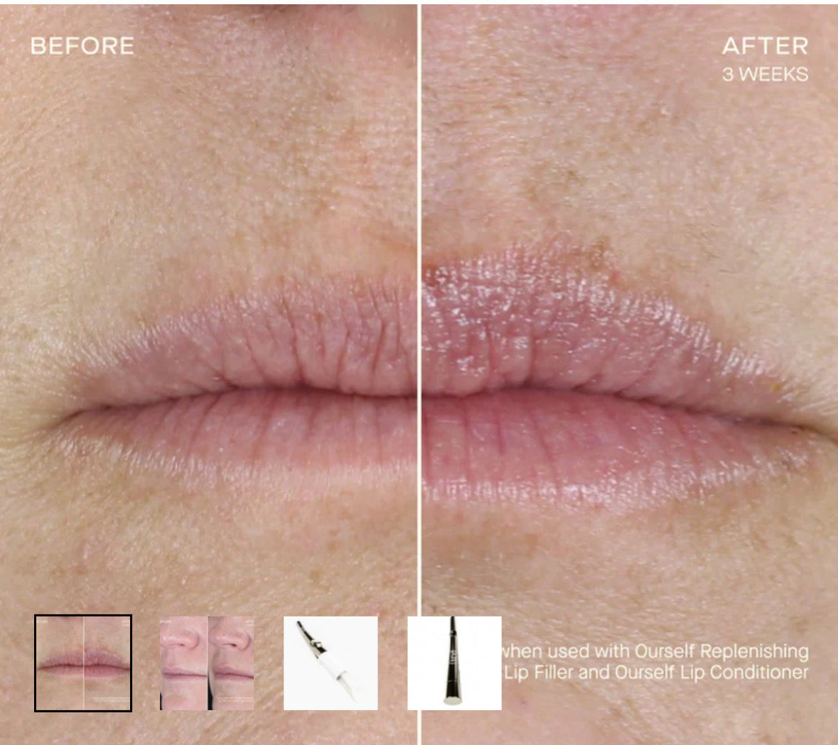 Ourself replenishing lip filler