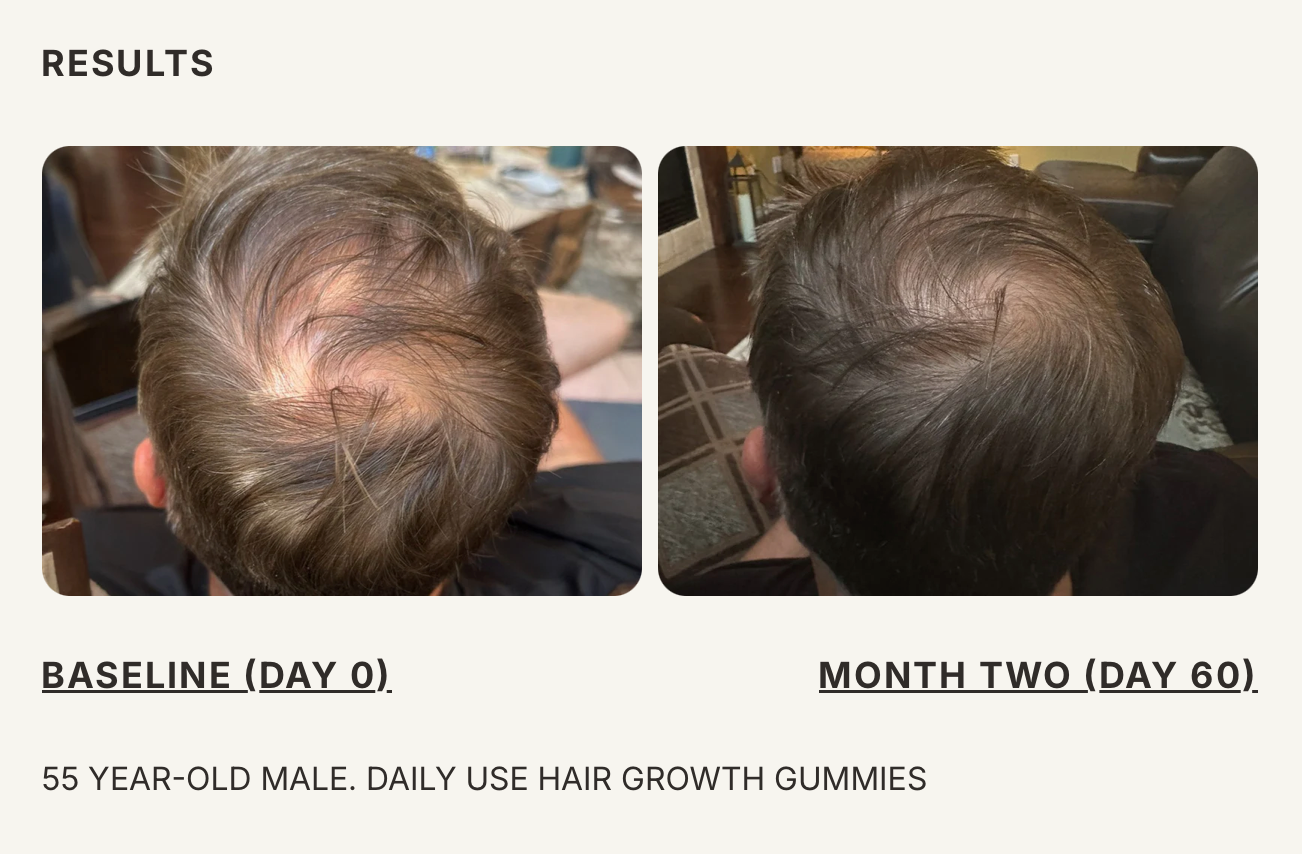 Hair Growth Gummies